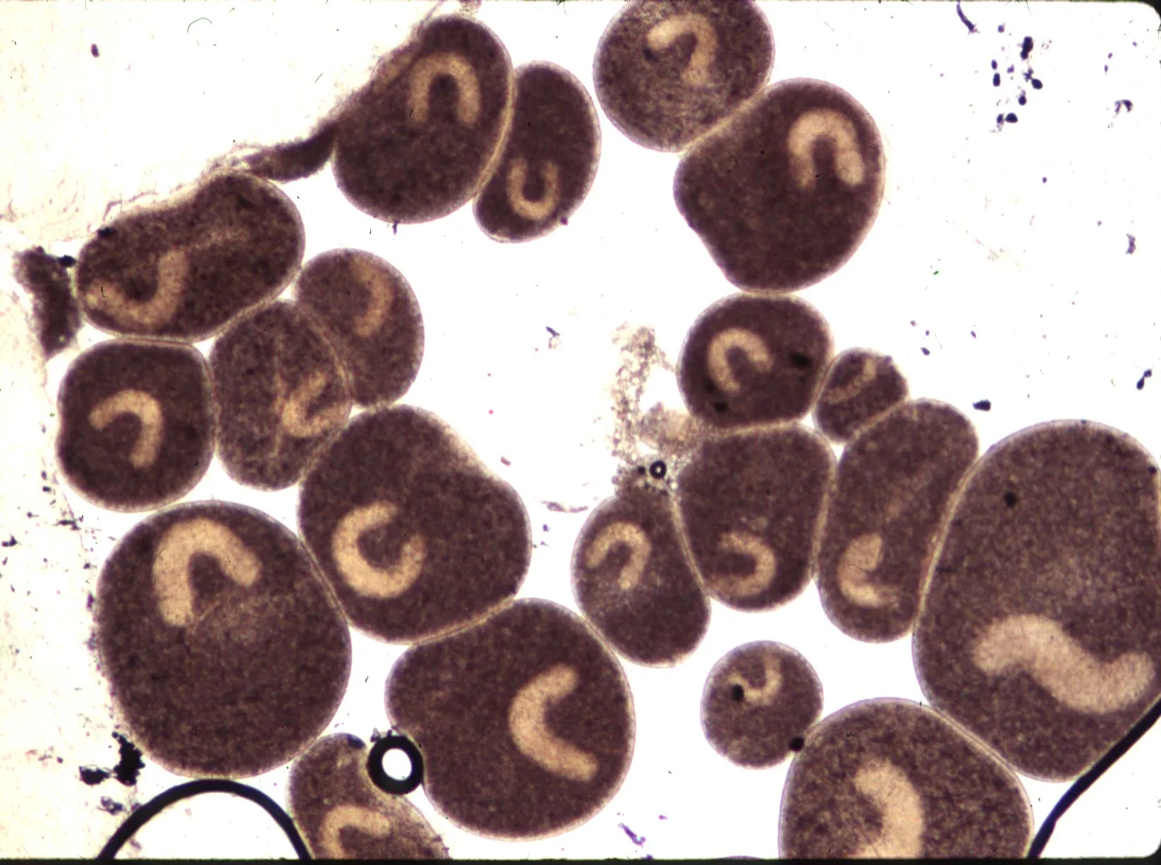 Ichthyophthirius multifiliis parasite under magnification
